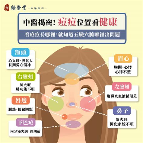 下巴生痘|下巴長痘痘怎麼消？專家揭5原因！6方法改善、不能吃…